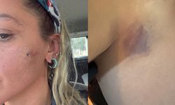 Hayat Bilgisi dizisinin ‘Rüya’sı’ Yıldız Asyalı şiddete uğradı: Peki ünlü oyuncuyu kim darbetti?