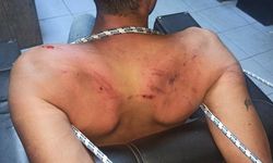 Hamamböceği yedirildi, işkence edildi! 6 yıl 12 ay ceza verildi!