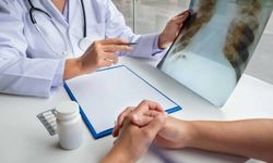 Kepez’de kansere farkındalık: Sağlık tırı mahallelerde olacak