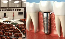 Meclise sunuldu! İmplant tedavisi ücretsiz mi olacak?