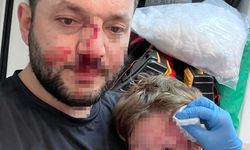 Komşu kavgasında olan çocuğa oldu: 14 aylık bebek hastanelik oldu