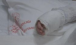 Üzerine kaynar su dökülen bebeğin vücudunun yüzde 27'si yandı