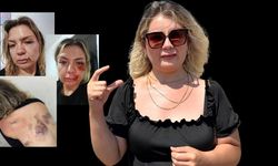 “Seni öld*receğim” deyip s*ldırdı! B*çak kırılınca da durmadı