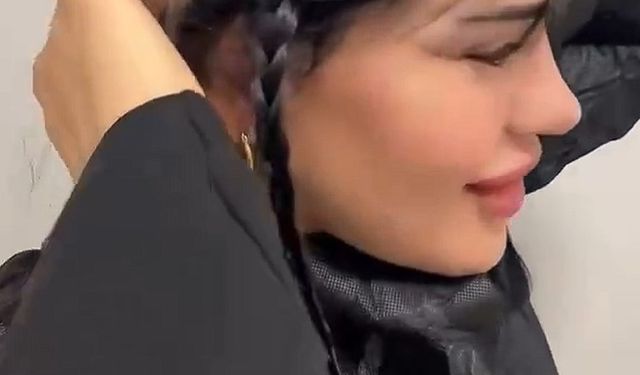 Estetik sonrası hali şoke etti, Hülya Mizgin kel kaldı!