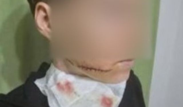 Tanımadığı kadına yumrukla ve bıçakla saldırdı, gözaltına alındı