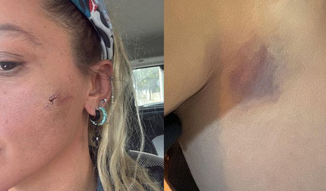 Hayat Bilgisi dizisinin ‘Rüya’sı’ Yıldız Asyalı şiddete uğradı: Peki ünlü oyuncuyu kim darbetti?