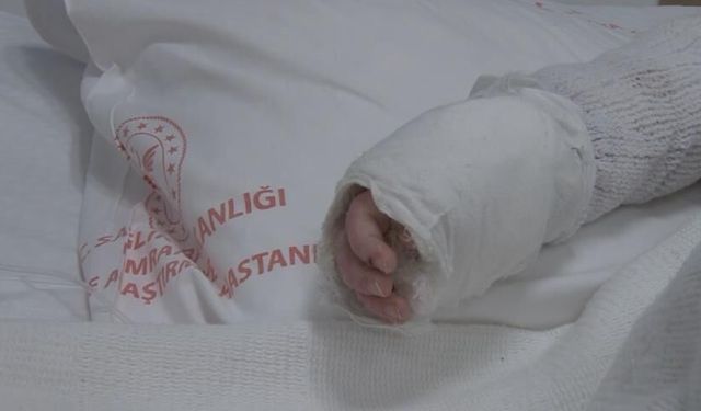 Üzerine kaynar su dökülen bebeğin vücudunun yüzde 27'si yandı