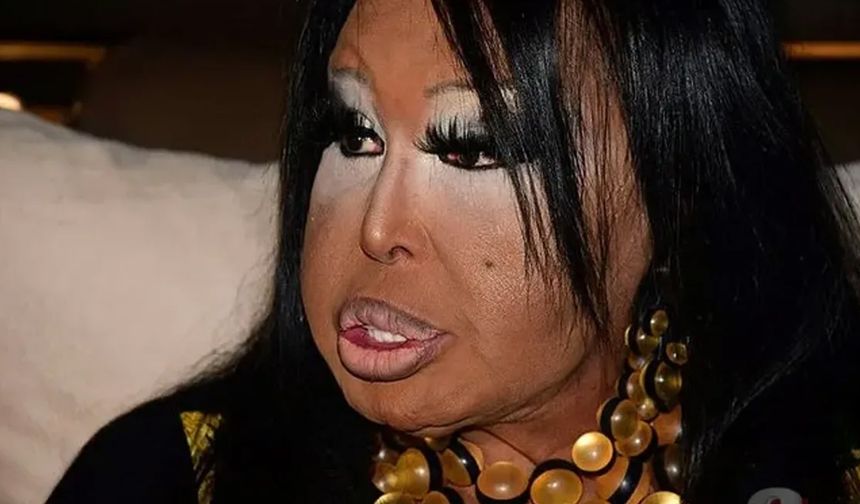 Bülent Ersoy'da yangından nasibini aldı!