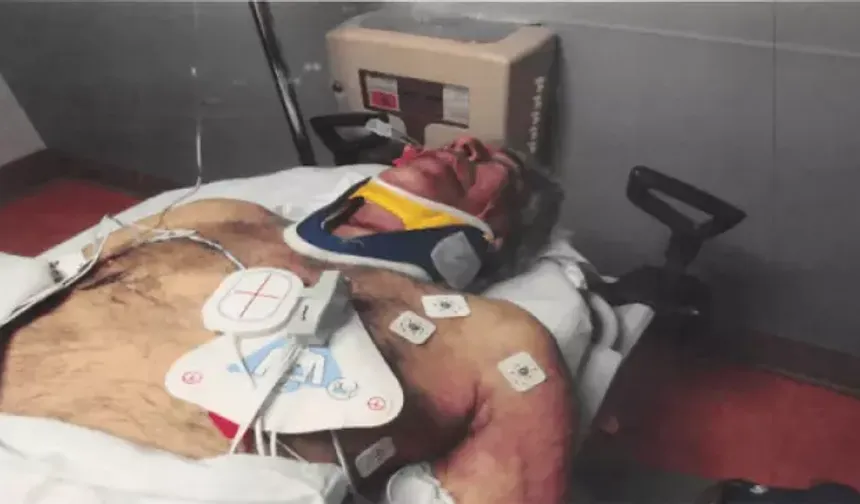 Eski sevgili açıkladı! "Epstein ölmedi, c*setler değiştirildi"