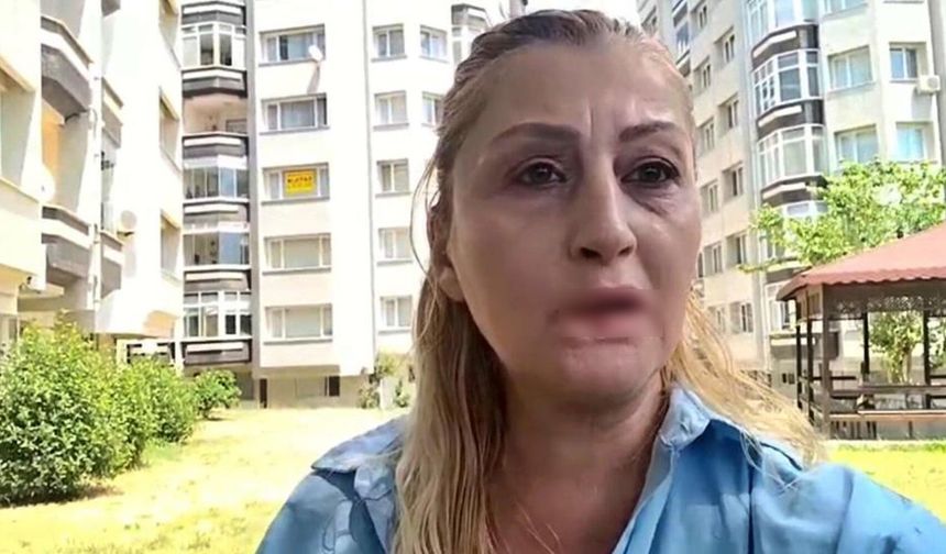 Estetik sonrası dudağını kaybetti! "Gülüşüm yok, hakkımı kim arayacak?"