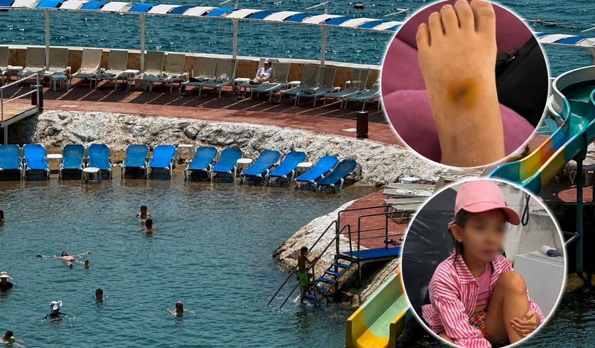 Alanya’da turist kızın tatili hastanede bitti: Aile ile otel yönetimi karşı karşıya!