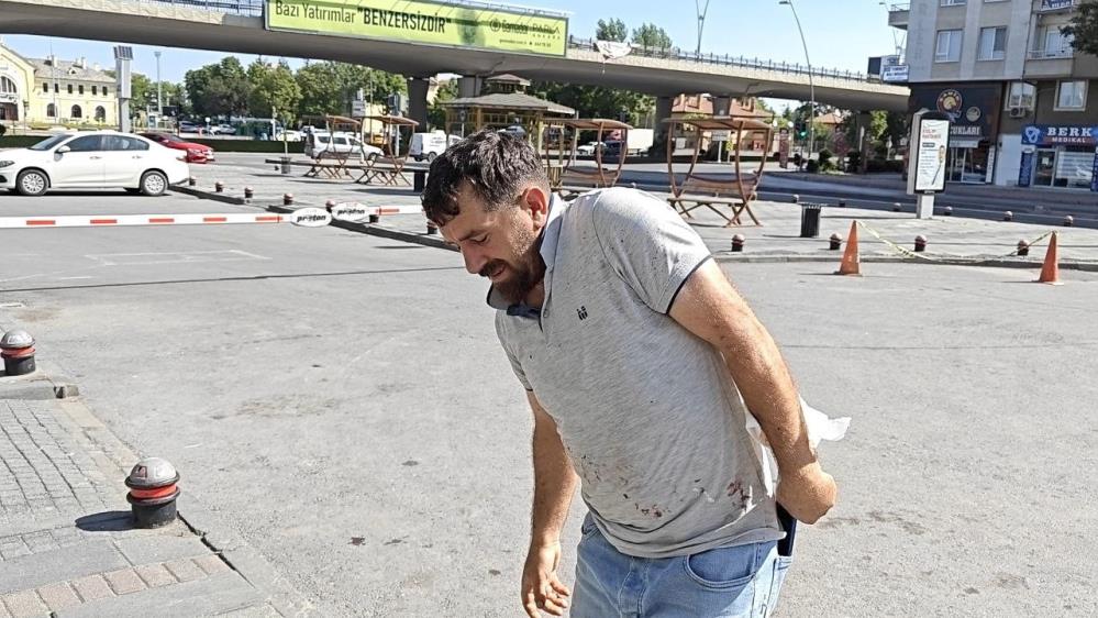 Acemikasaplarkendinikesti