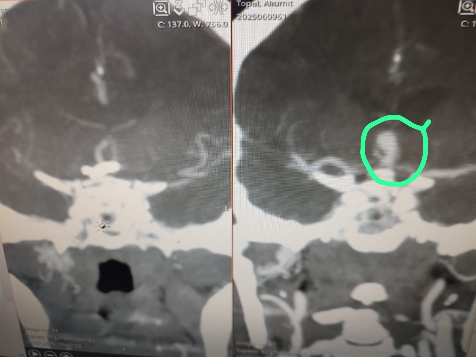 Kasindantedaviedildi1