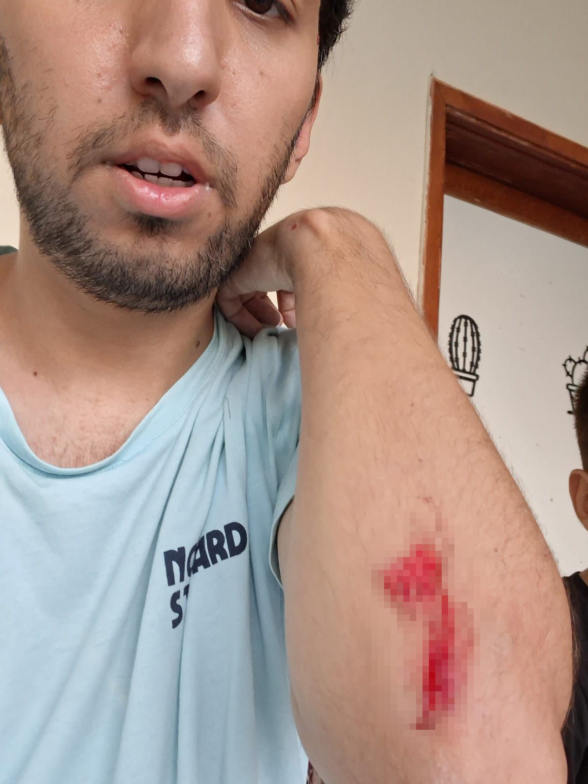 Aileceksiddetemaruzkaldilar