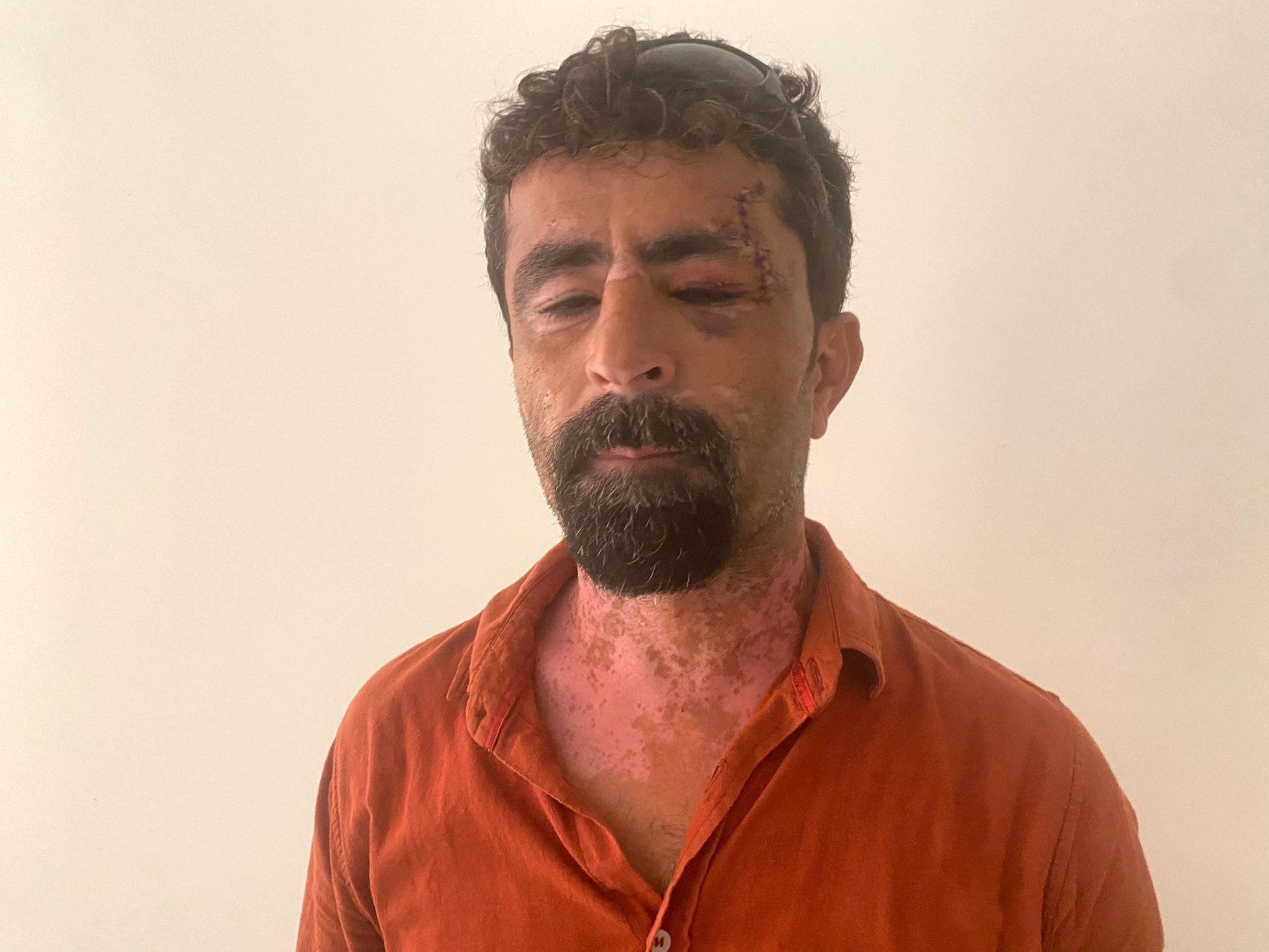 Eviterkedenesininhincinikayinpederindencikardi