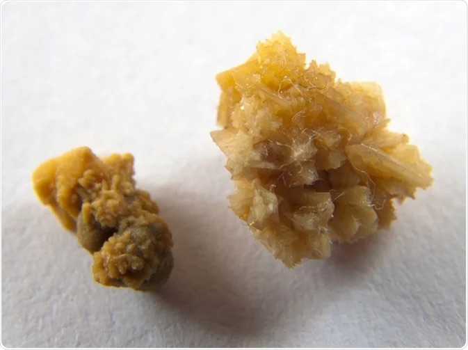 Uzmanlarbobrektasivesicakhavaninetkisikonusundauyardi