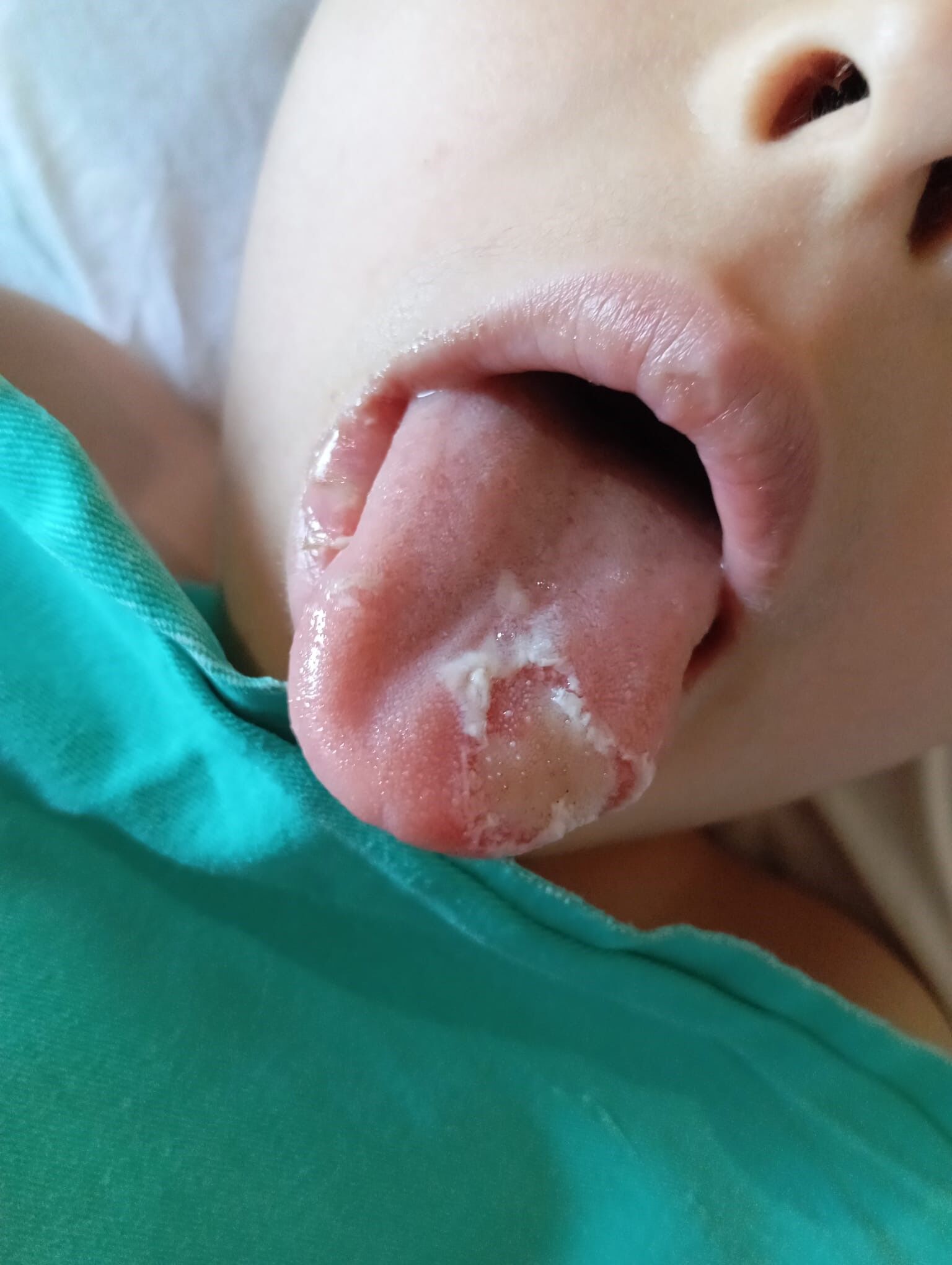 Ameliyattanyanarakcıktı