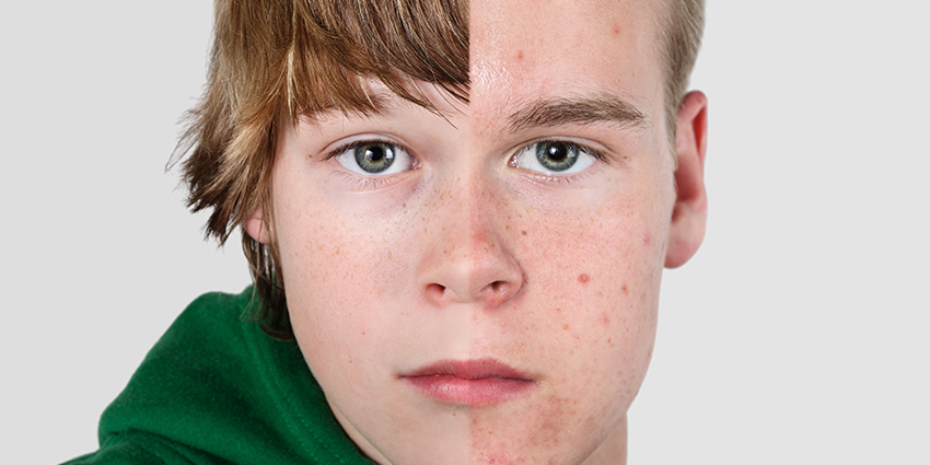 Erkenergenligintedavisivarmi