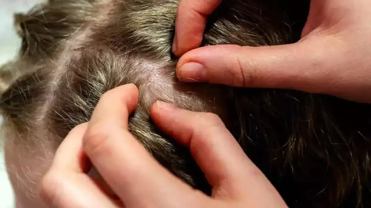 Hasaelerdennasilkorunuruz