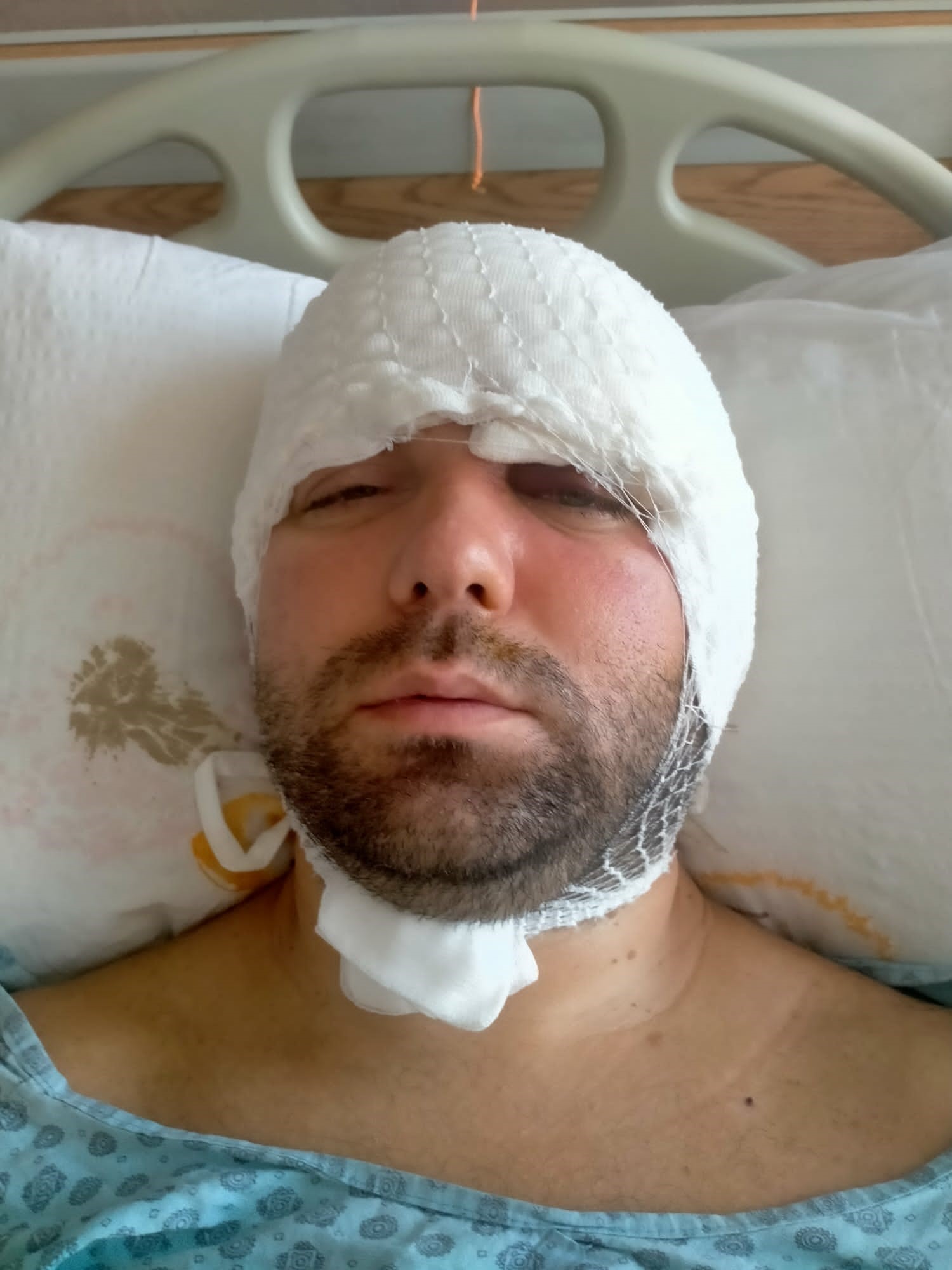 Bursadabeynineimplantsaplandi