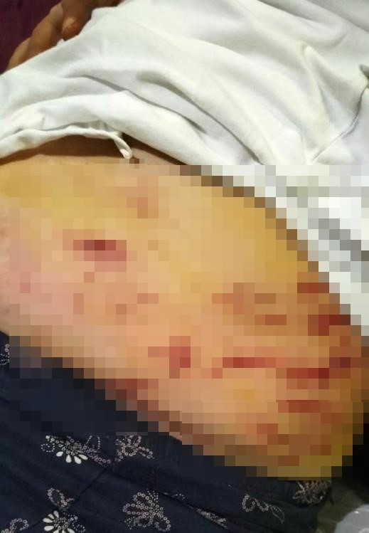 Cinskopekikikisiyesaldirdi