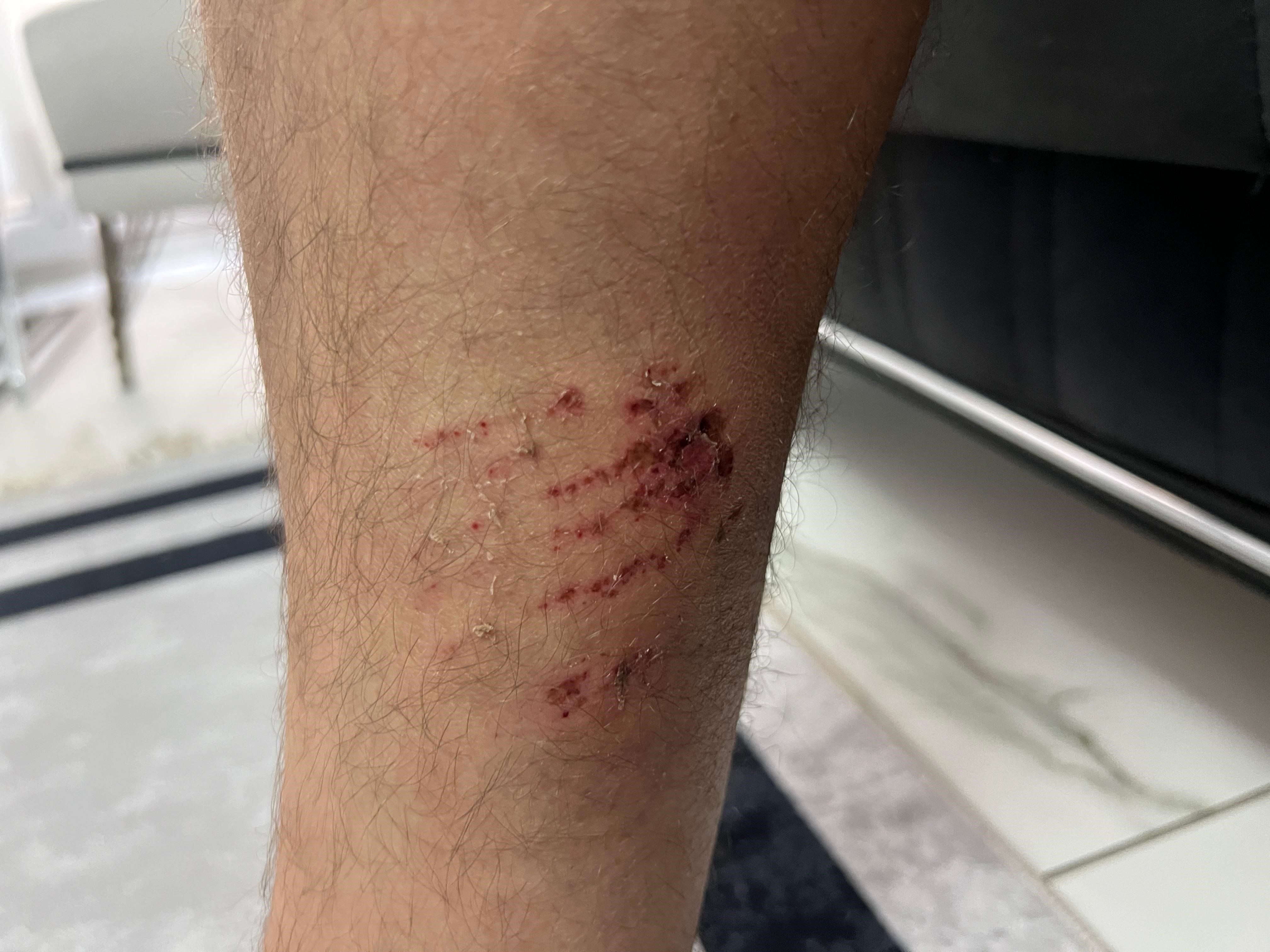 Hayvanazararvermekistemedim