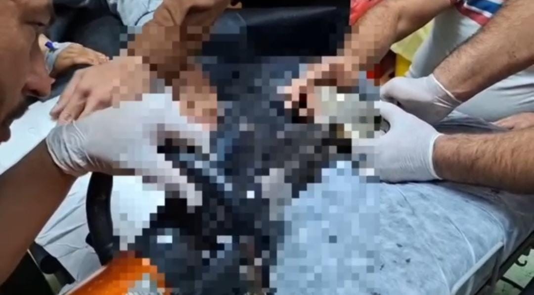 Kucukcocukelinimakinayakaptirdi