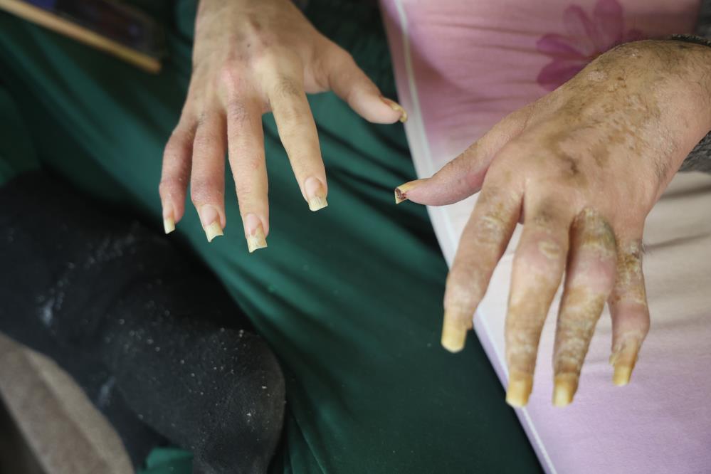 Telefonsuzyasayamiyorhatay