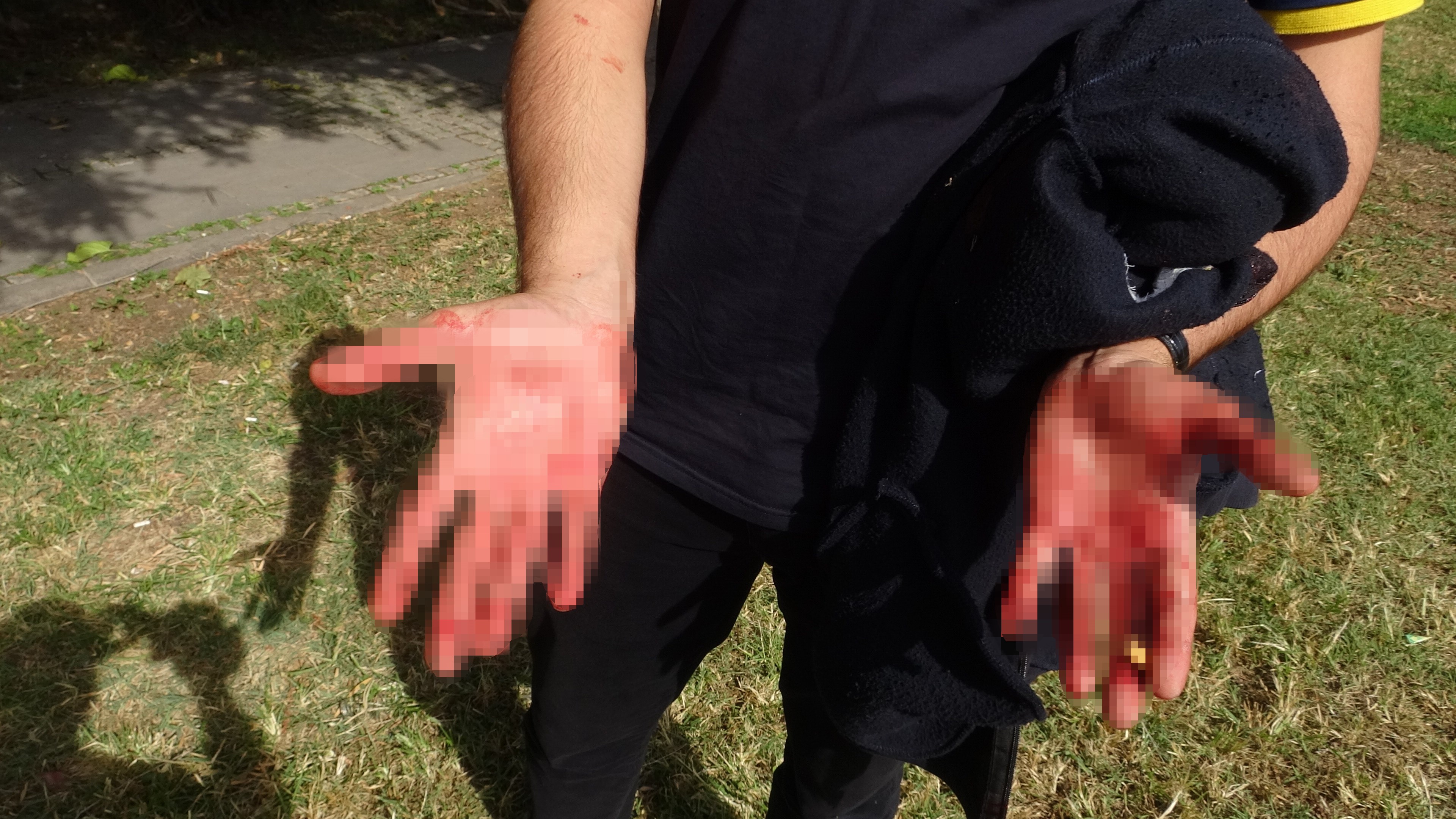 Bicaklayoldangecenadamiyaraladi