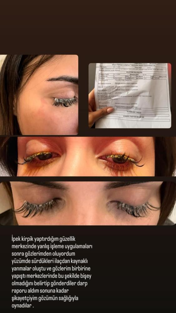 Guzellikugrunazdahakoroluyordu