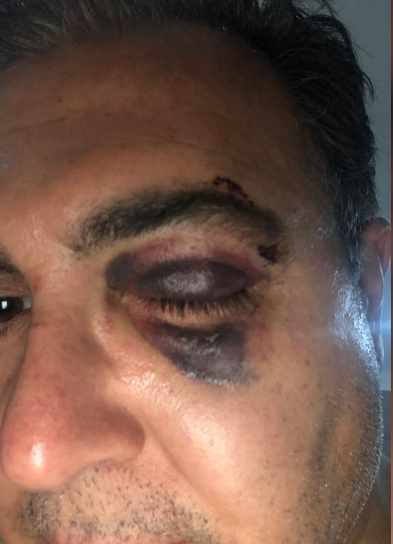 Istanbuldaisinsaninasokeedensaldirisebepkedicikti