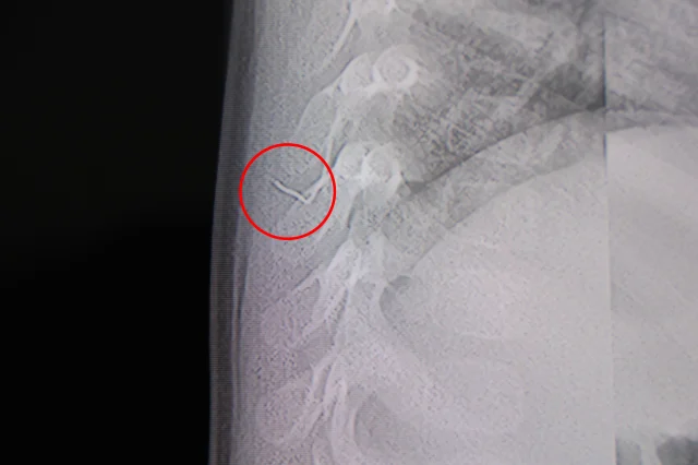 1Yasindakibebeksirtustuyatmakistemedi