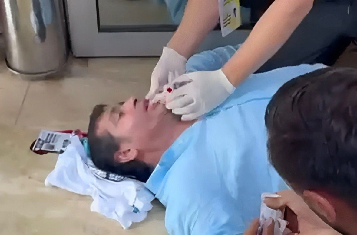 Baskanbenivurmakistiyorlardedi