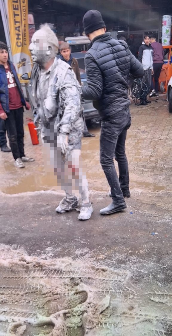 Diyarbakirdasanayidekorkutanpatlama1Iagir4Yarali