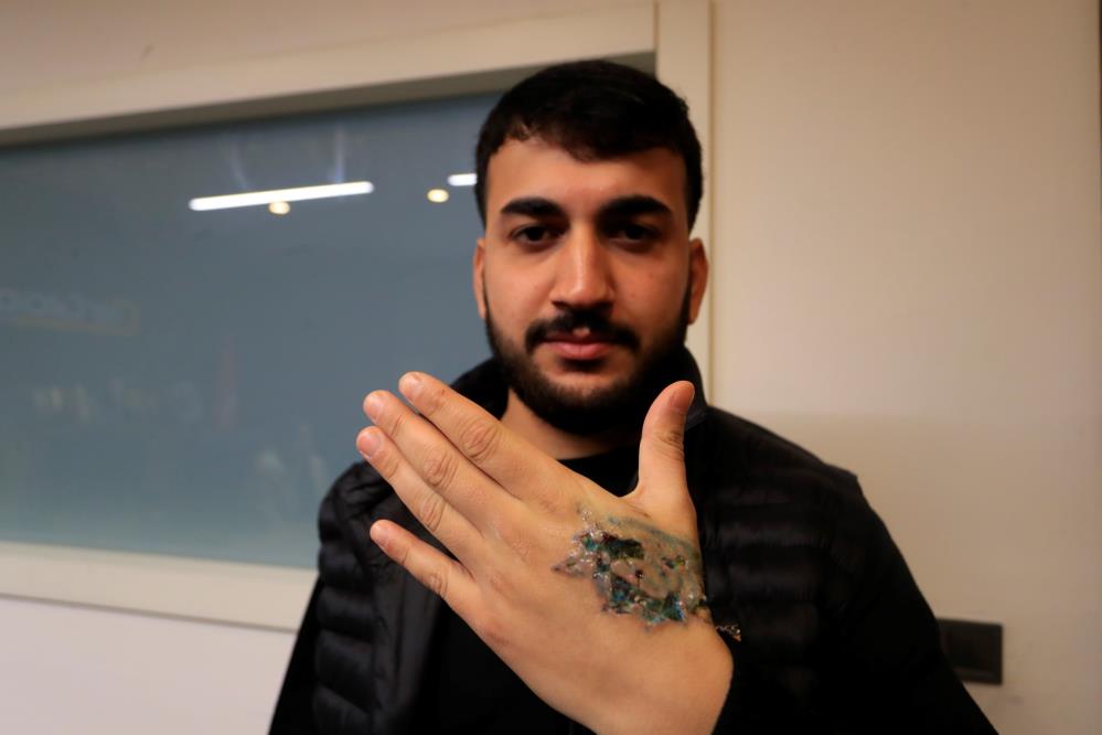 Elindekidovmeyisildirmekistediyanlısislemsonucudokukaybıolustu