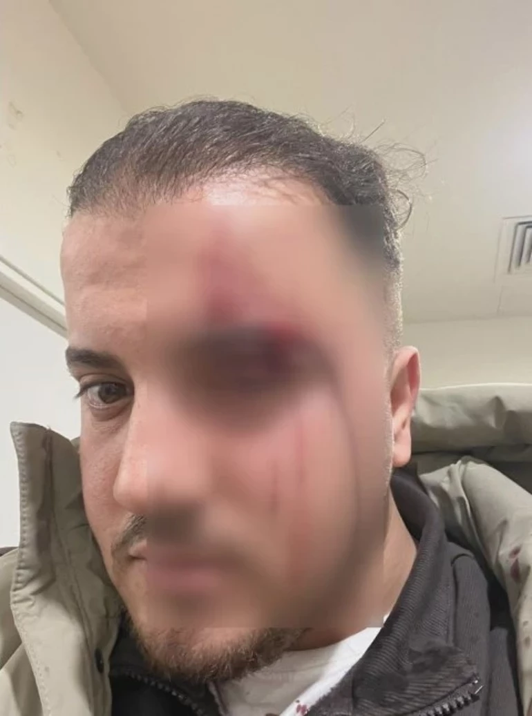 Herseykamerayigoruncedegisti