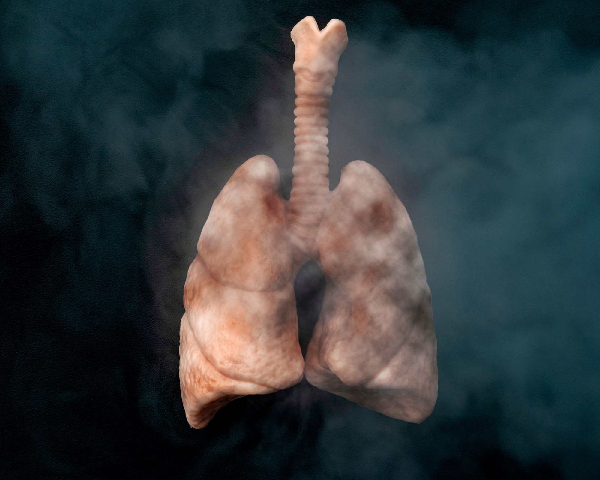 Sigaraicenlerdeakcigerkanseririski30Katartiyor