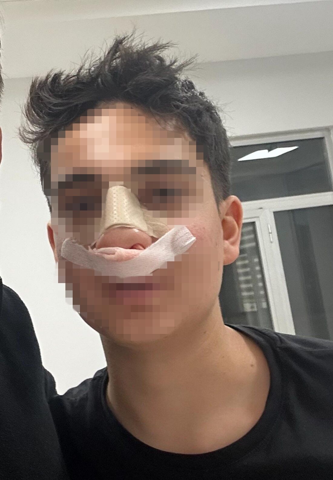 Antalyadanedenbakiyorsuntartismasikanlibitti15Yasindakigencinburnukirildi