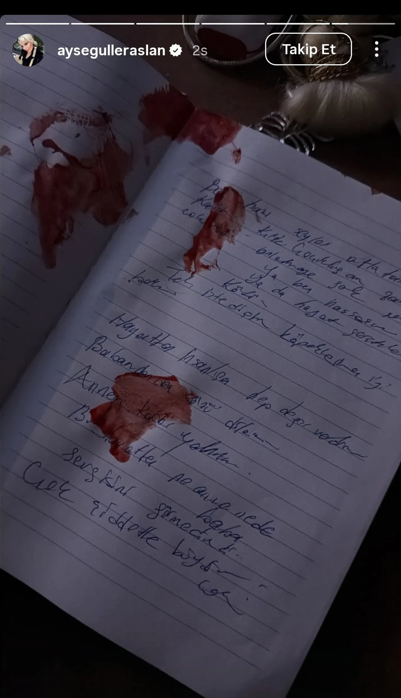 Ayseguleraslanhayatinikaybetti