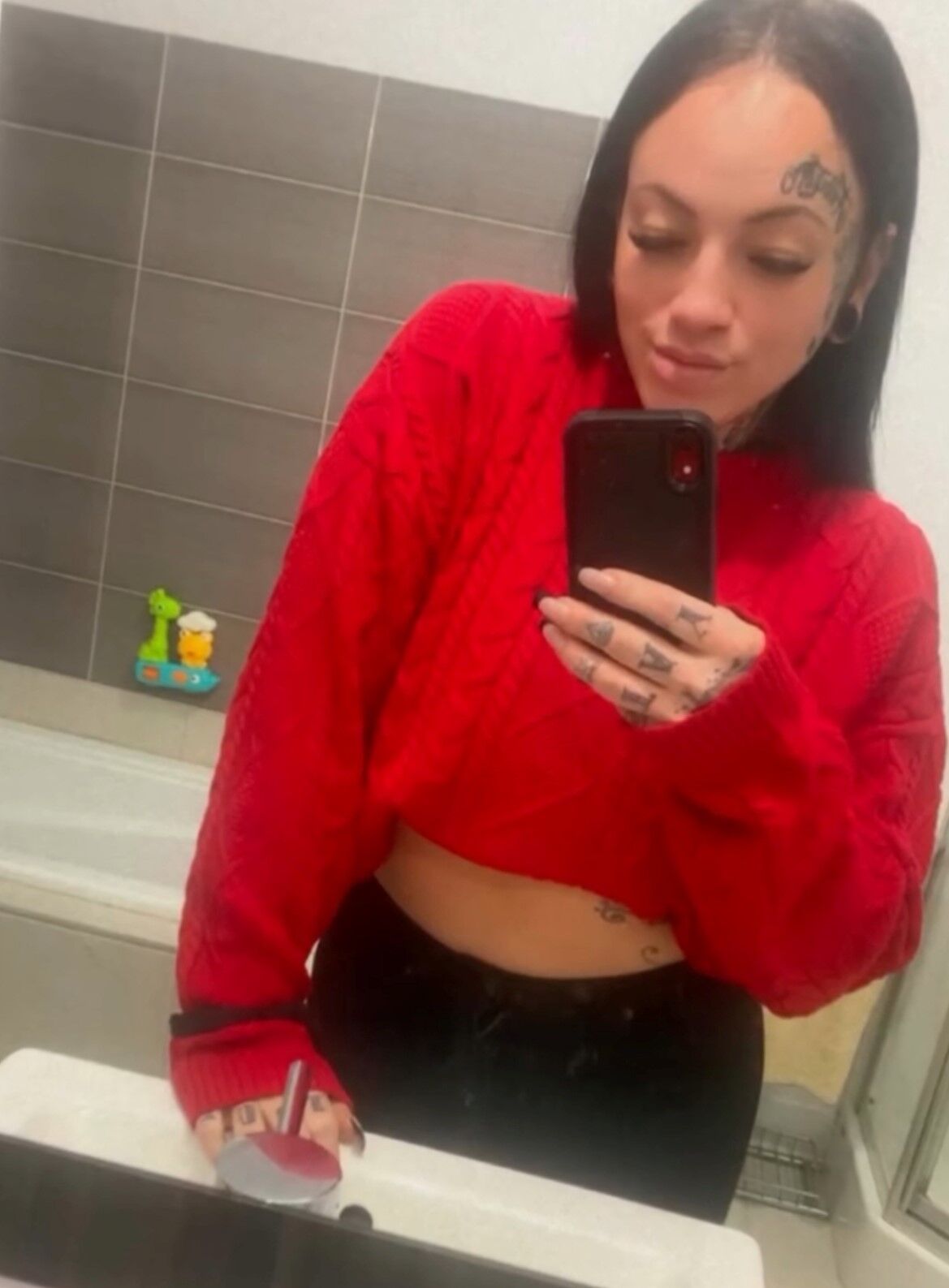 Estetikoperasyonsonrasitrajikolum